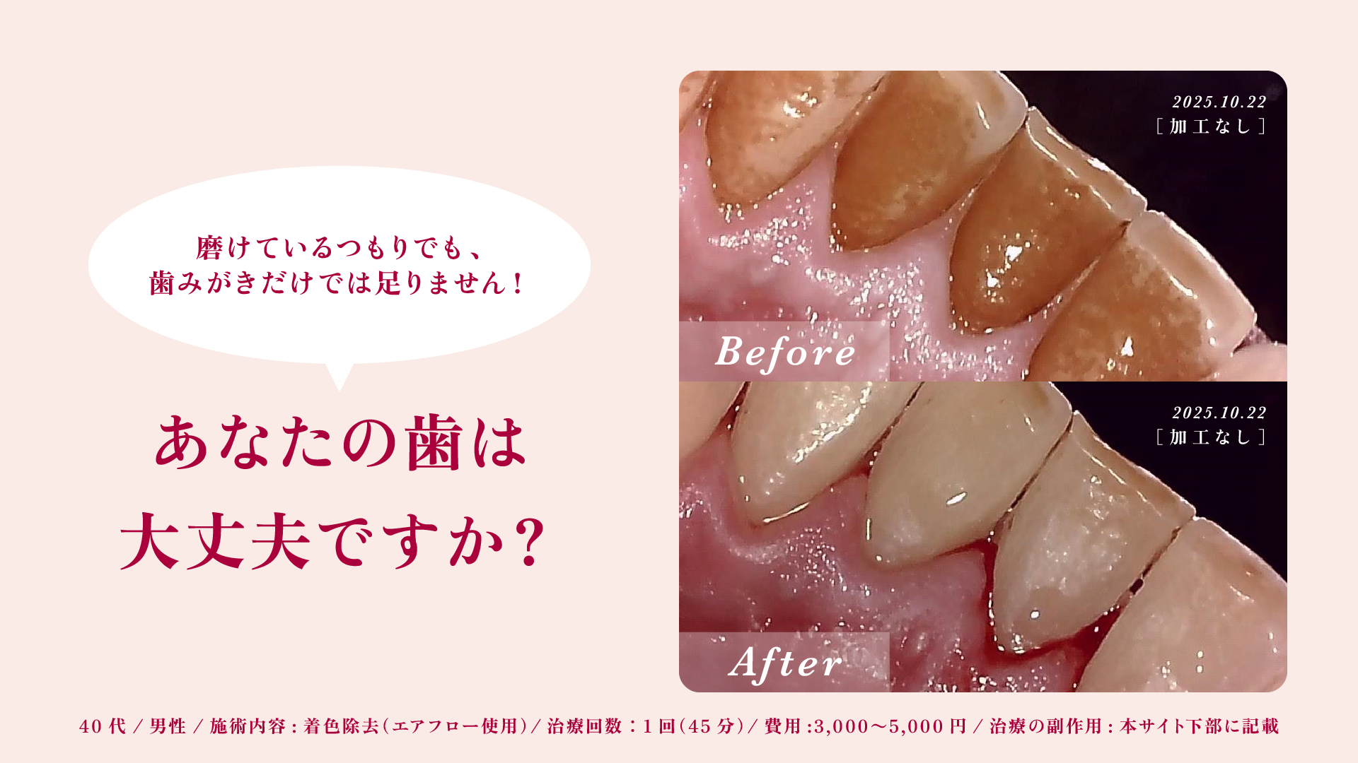 あなたの歯は大丈夫ですか?